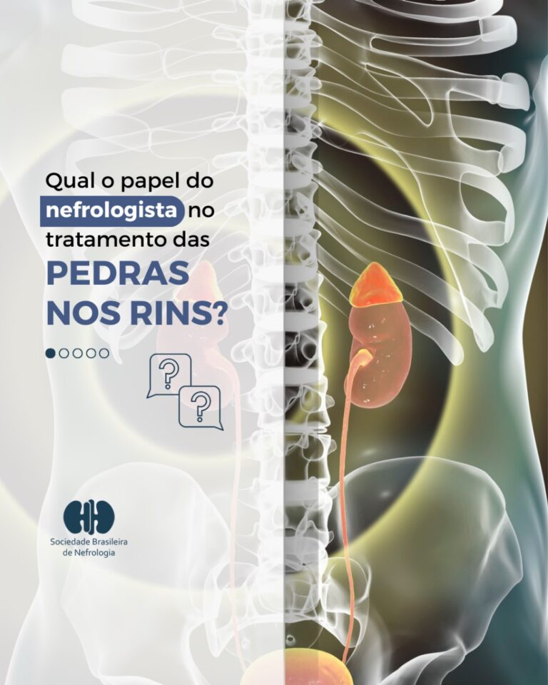 Qual o papel do nefrologista no tratamento da pedra nos rins?