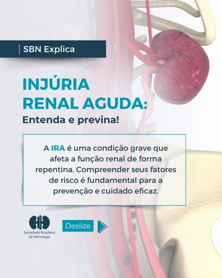 SBN Explica: Entenda o que é Injúria Renal Aguda (IRA)