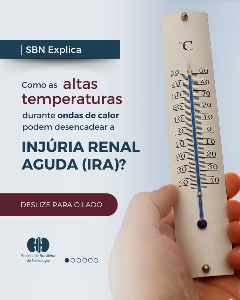 SBN Explica: Como as altas temperaturas podem desencadear a Injúria Renal Aguda