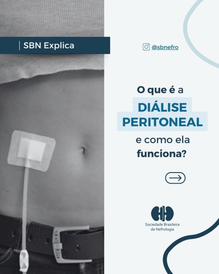 SBN Explica: O que é Diálise Peritoneal e como ela funciona?