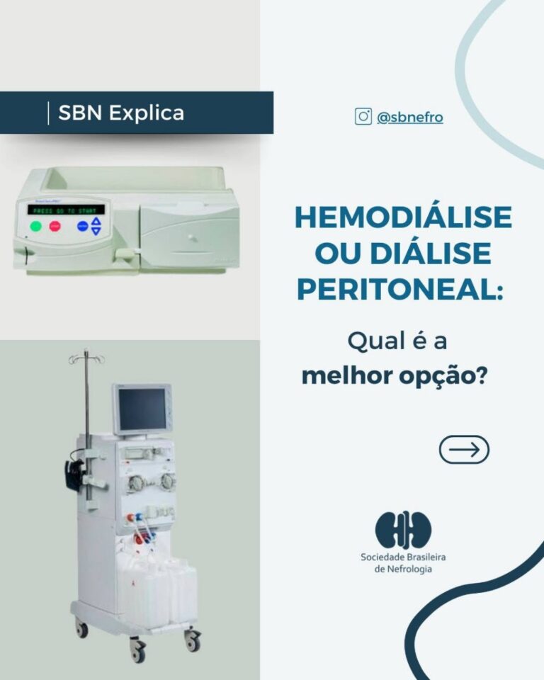 SBN Explica: Hemodiálise ou Diálise Peritoneal, qual a melhor opção?