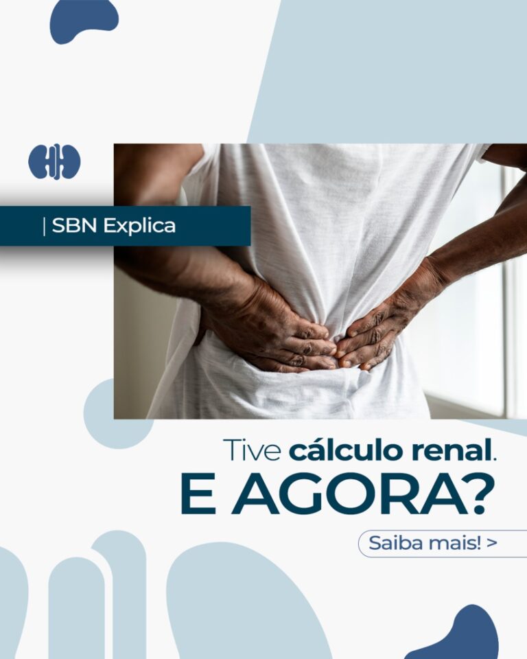 SBN Explica: Tive cálculo renal, e agora?