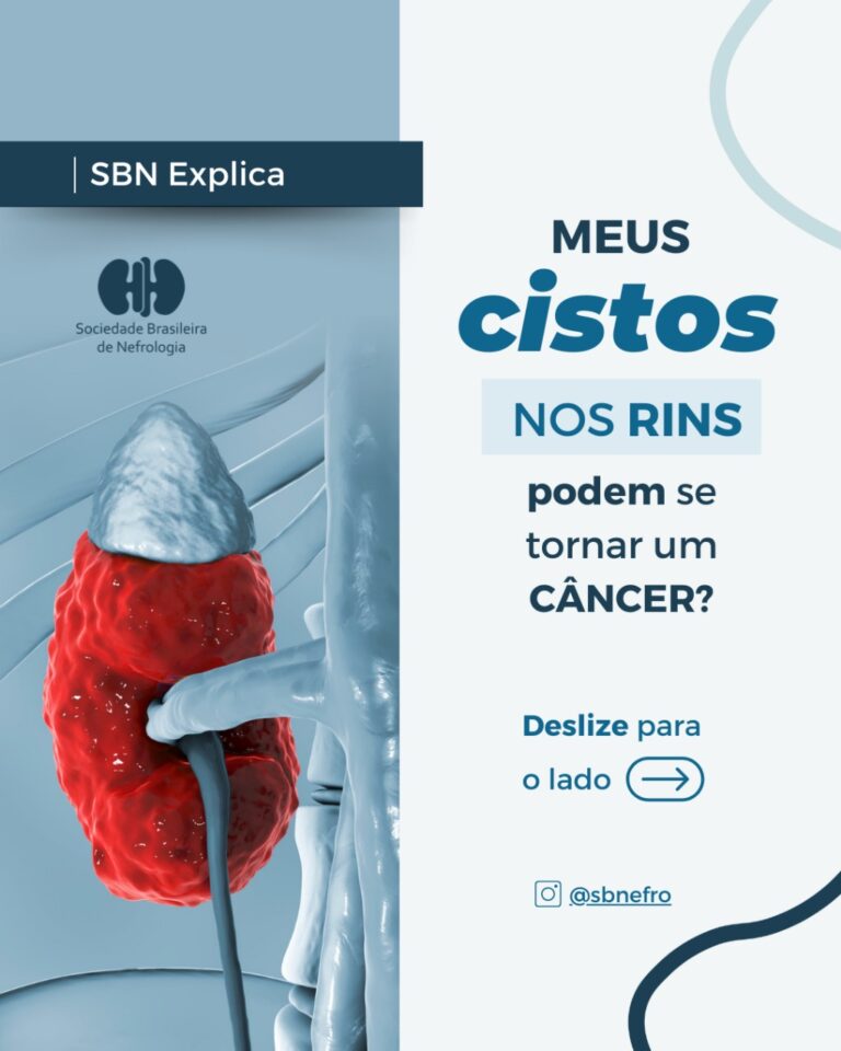 SBN Explica: Meus cistos nos rins podem se tornar um câncer?