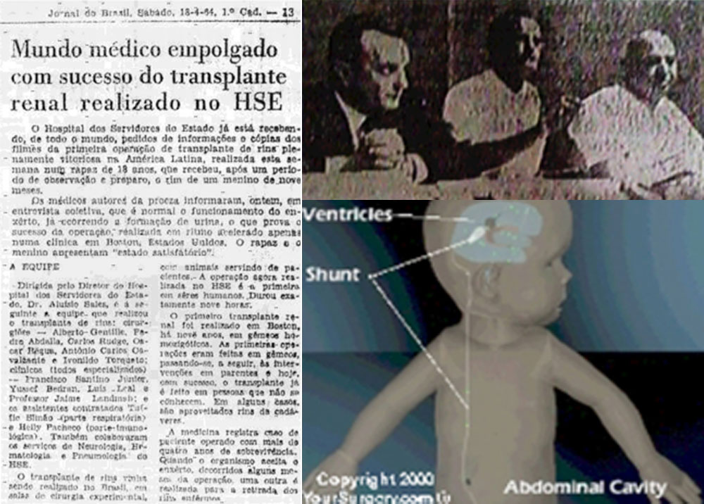 sbn_museu_nefrologia_1_transplante_renal_brasil-5