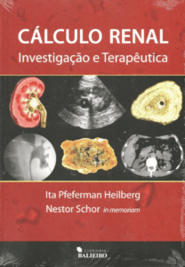 Cálculo Renal Investigação e Terapêutica