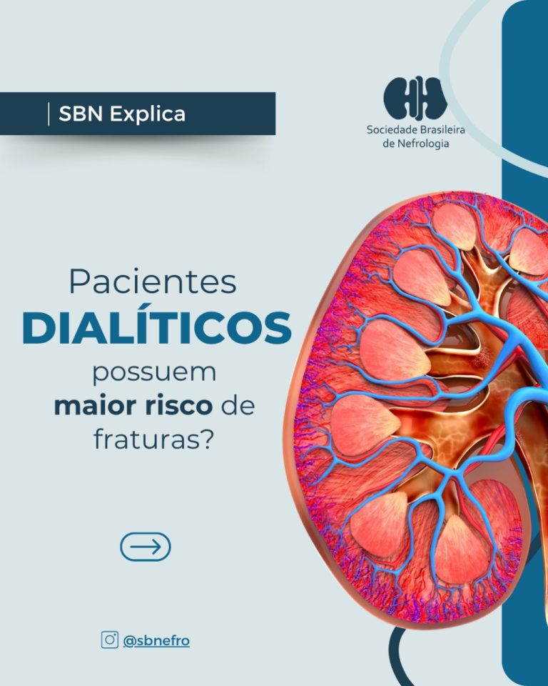 SBN Explica: Pacientes dialíticos têm maior risco de fraturas?