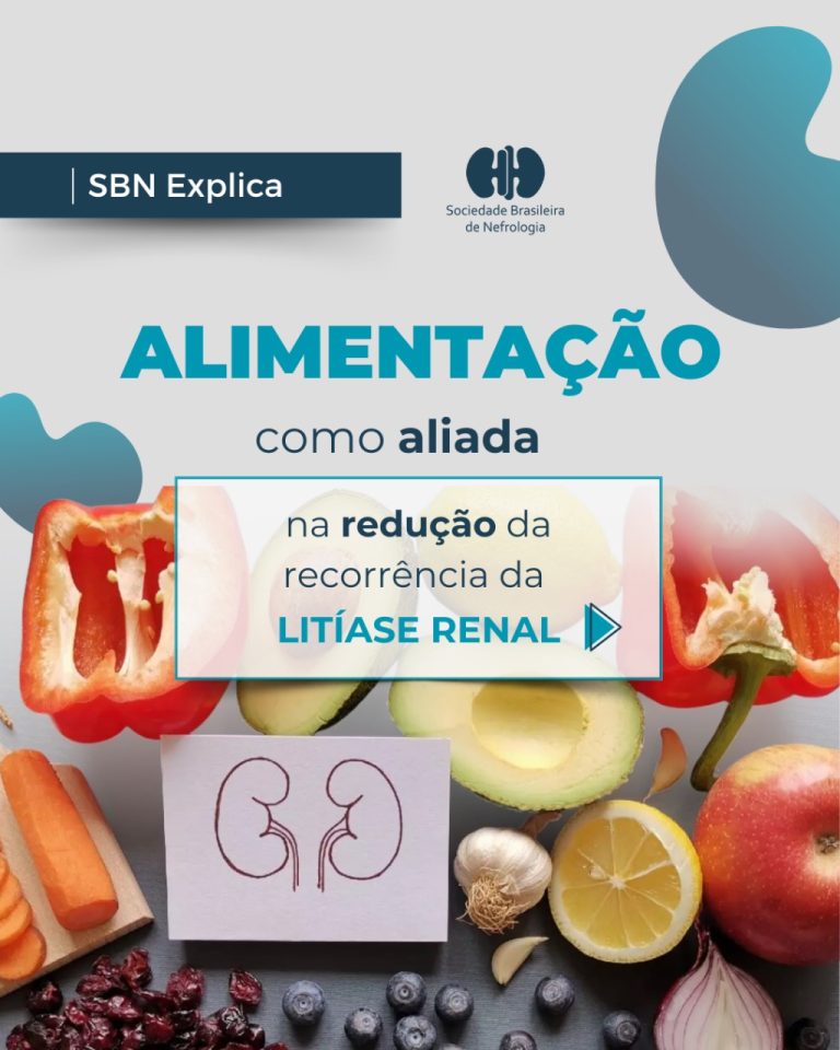 SBN Explica: Pedra nos rins é comum, mas a recorrência não precisa ser