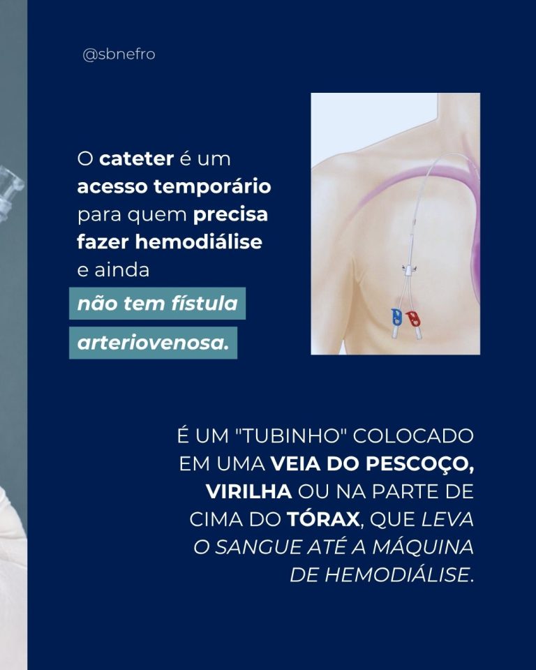 O cateter de hemodiálise exige cuidados diários para ajudar a prevenir infecções e outras complicações