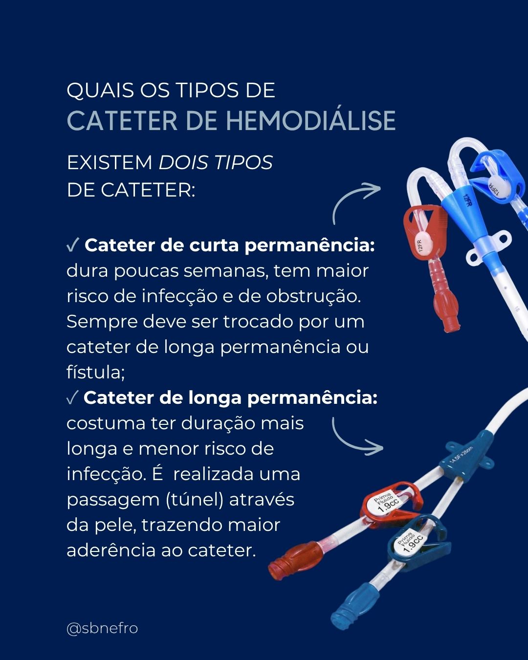 cateter-hemodialise