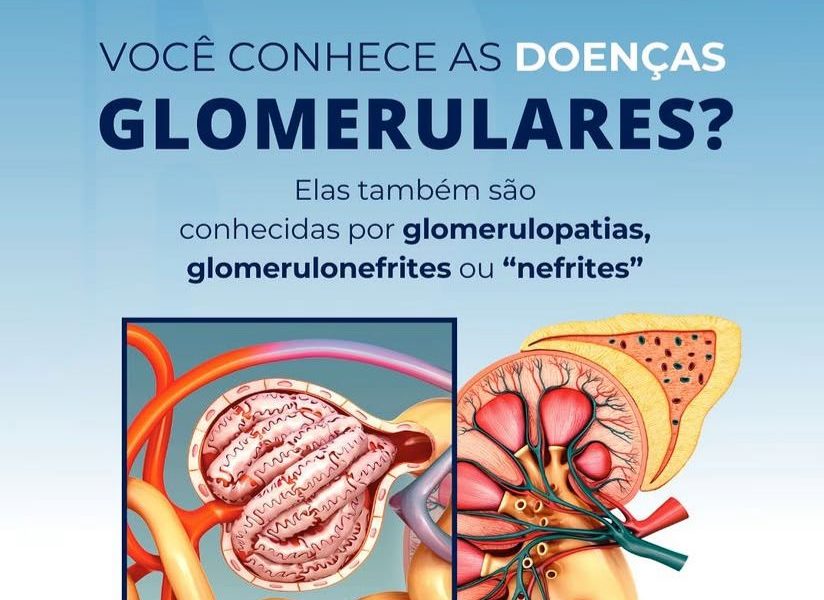 Você já ouviu falar em doenças glomerulares