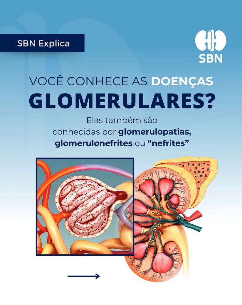 Você já ouviu falar em doenças glomerulares
