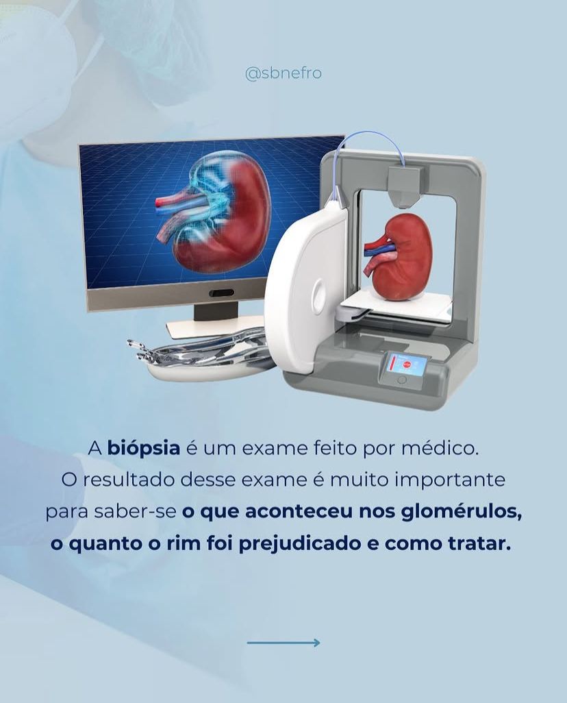 Você já ouviu falar em doenças glomerulares