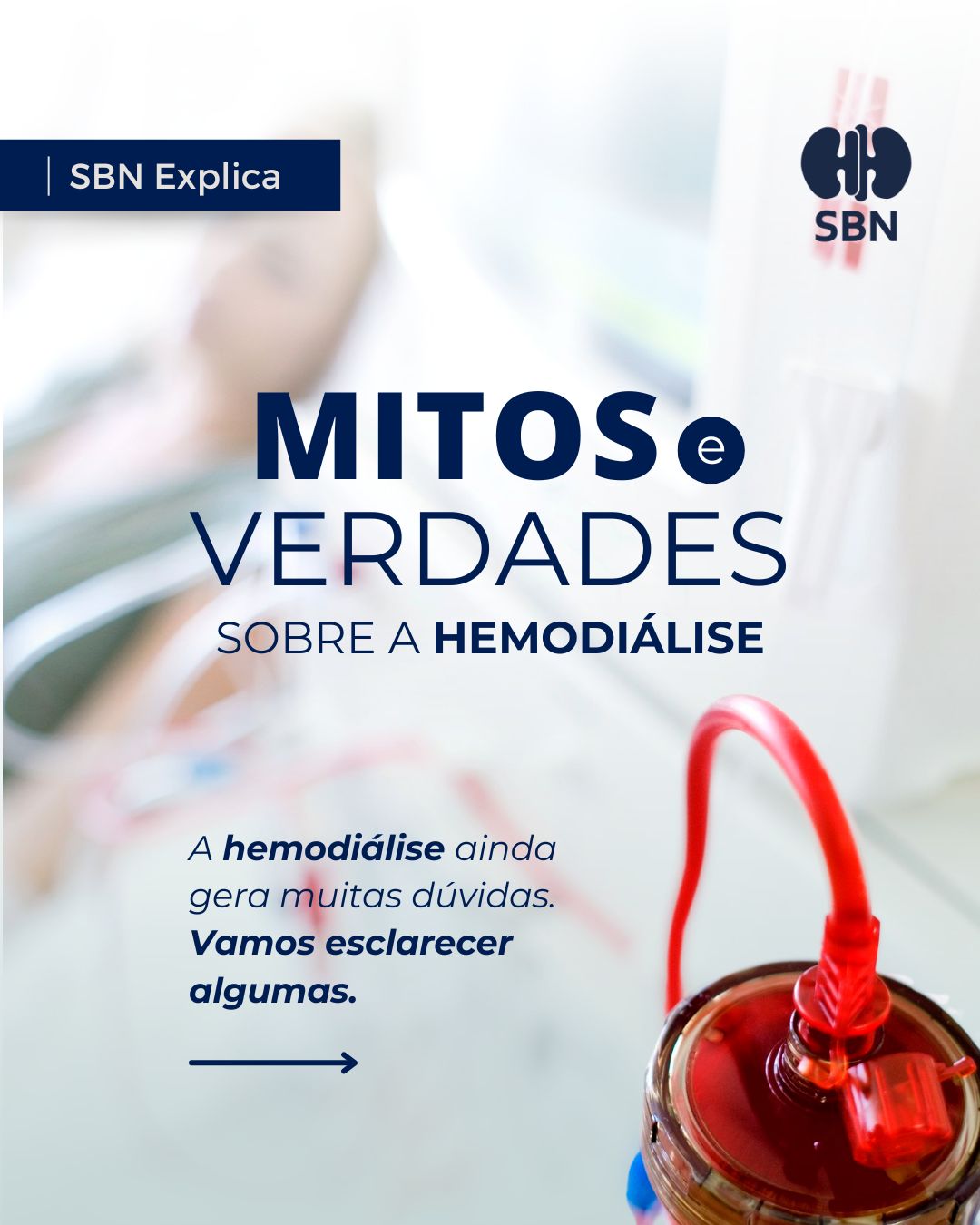 mitos-e-verdades-sobre-a-hemodialise