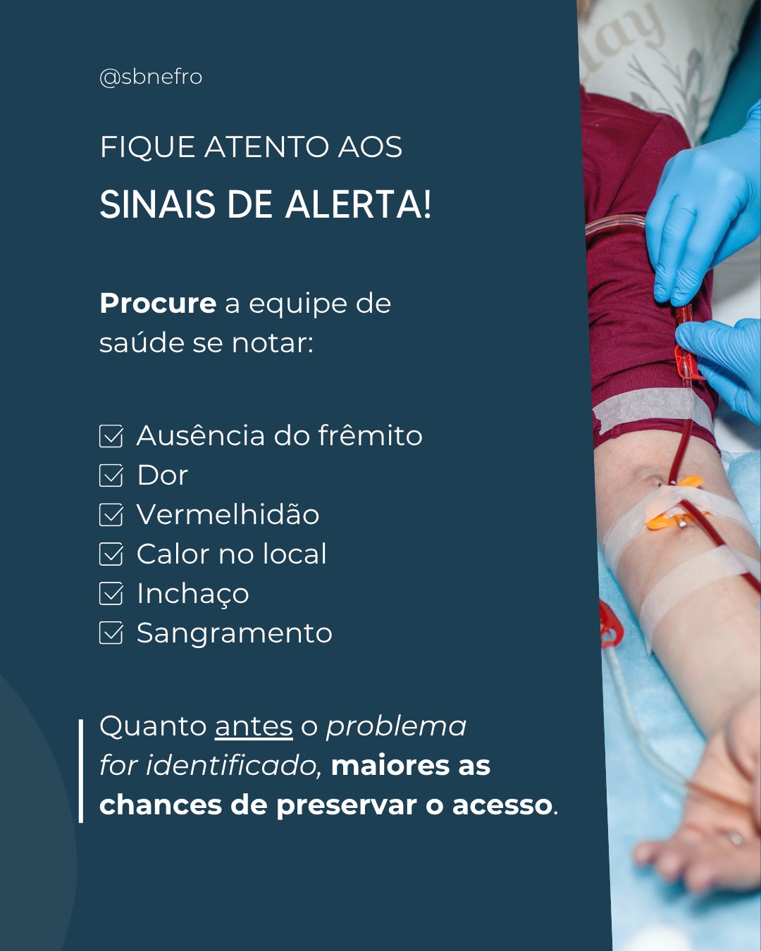 A fístula arteriovenosa