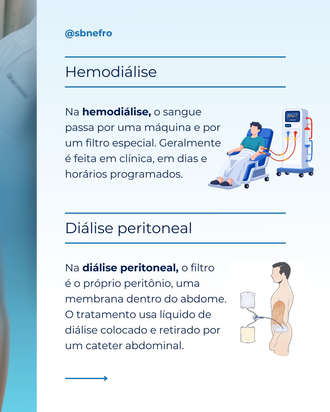Você sabe qual é a diferença entre a hemodiálise e a diálise peritoneal