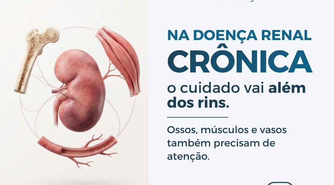 SBN destaca cuidados com a saúde óssea de pessoas com doença renal crônica