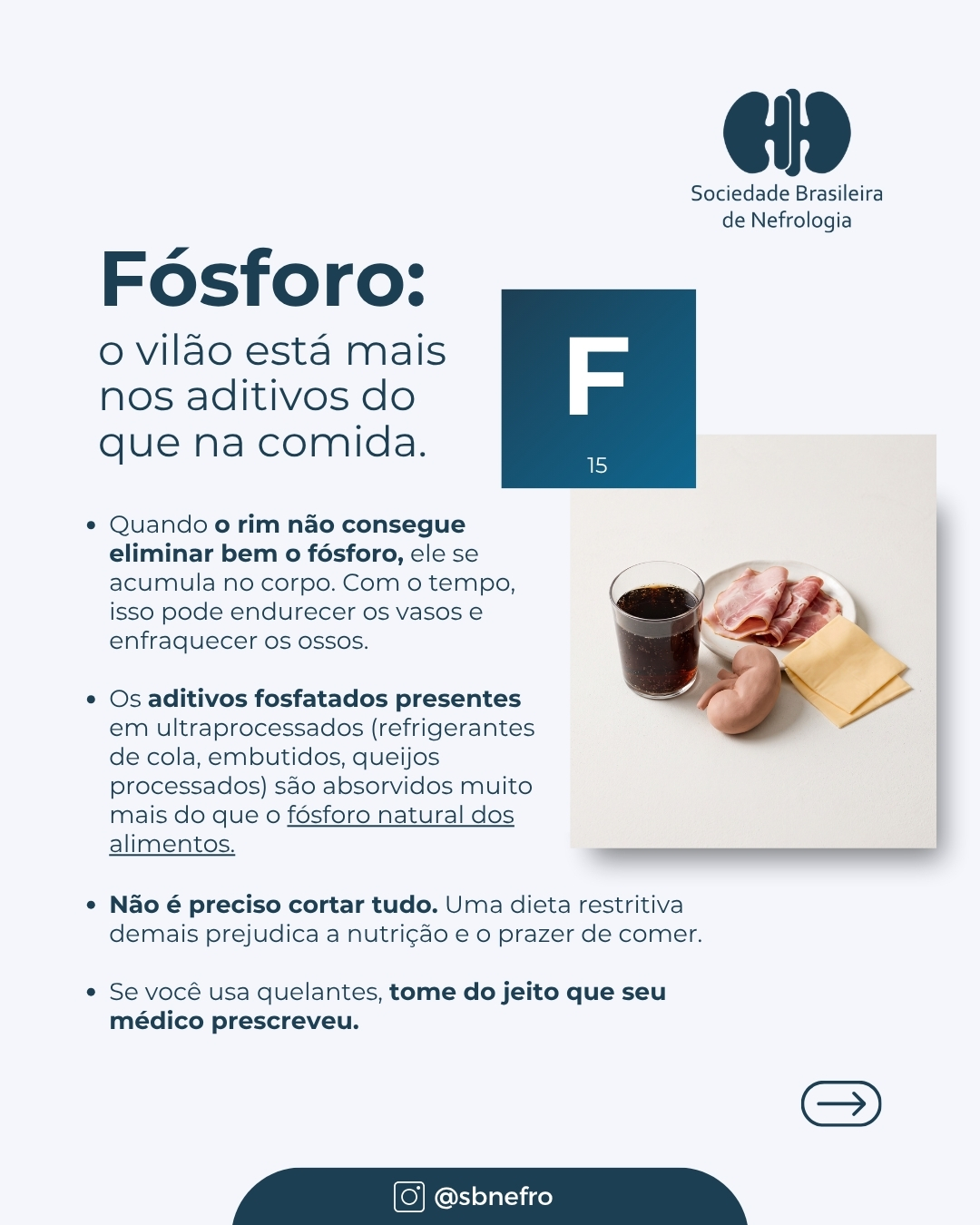 SBN destaca cuidados com a saúde óssea de pessoas com doença renal crônica