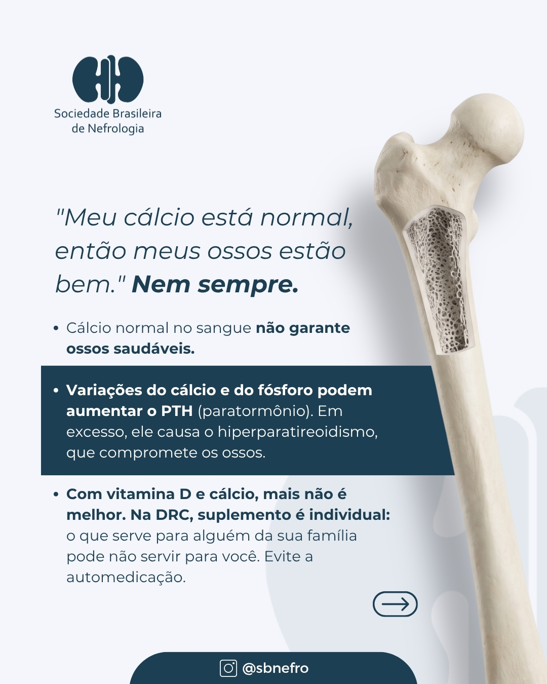 SBN destaca cuidados com a saúde óssea de pessoas com doença renal crônica