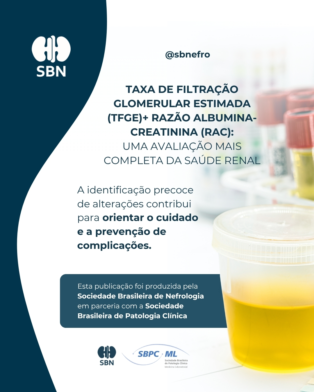 SBN e SBPC-ML destacam importância da avaliação conjunta da TFGe e da razão albumina-creatinina